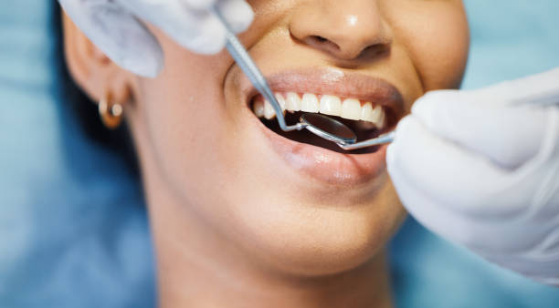 Best Dentist for Tooth Abscess  in Timnath, CO